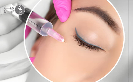 مزوژل جوانساز اسپانیایی زیر چشم در اختیاریه تهران؛ راهی برای شاداب‌تر شدن چهره